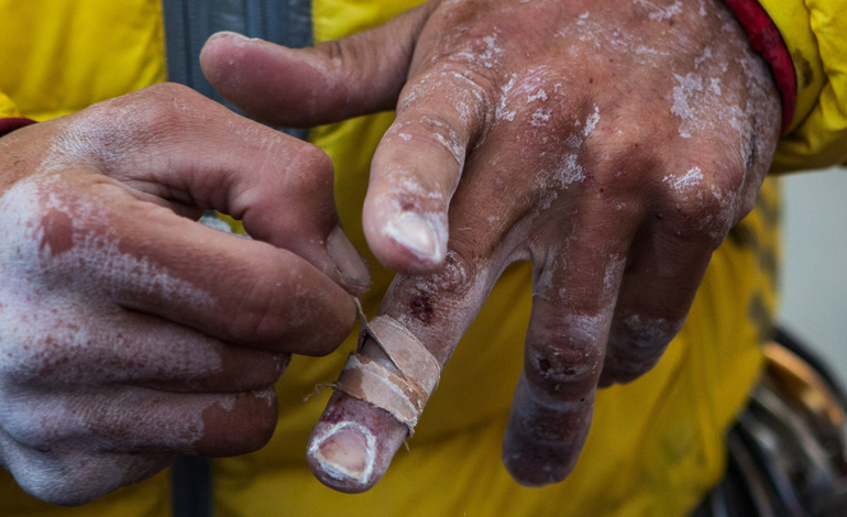 Kevin Jorgeson